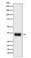 Anti-SF2 Monoclonal Antibody